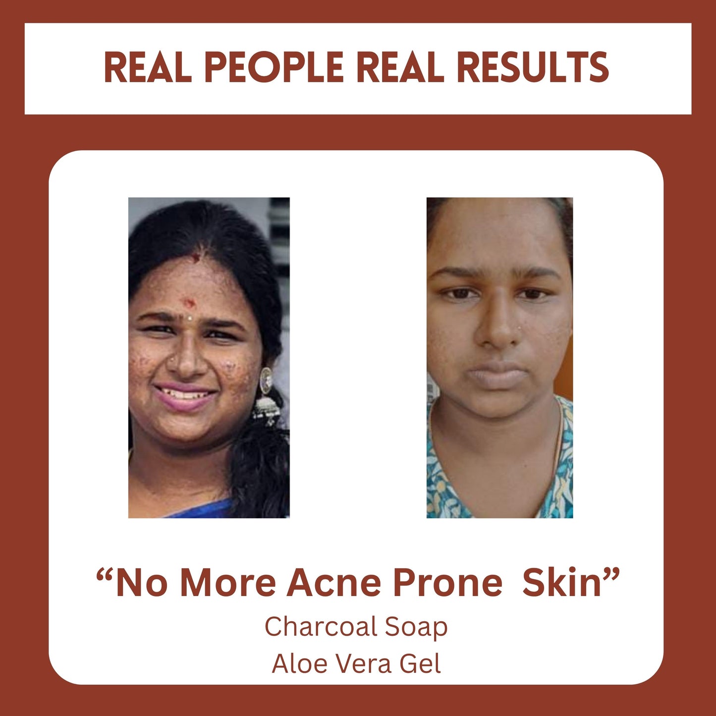 Oily Skin Combo