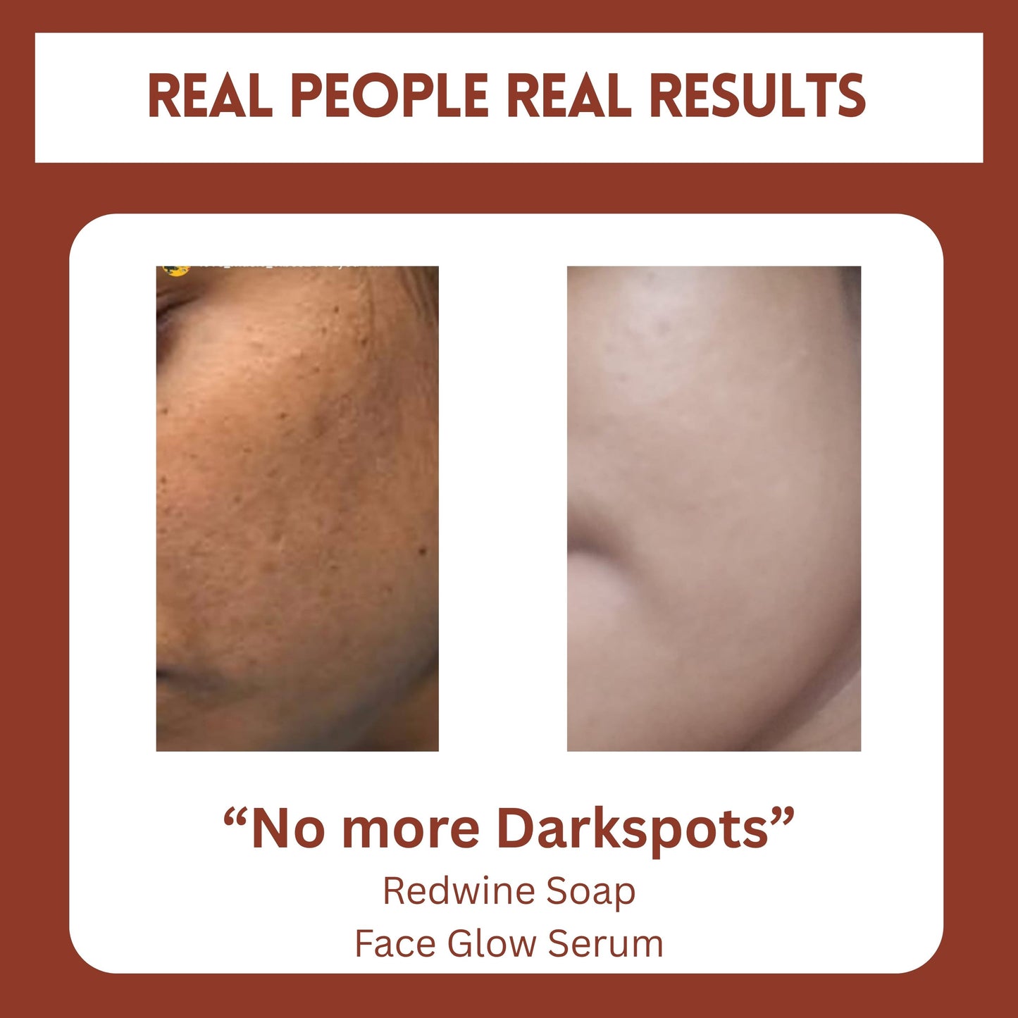 Dry Skin Combo