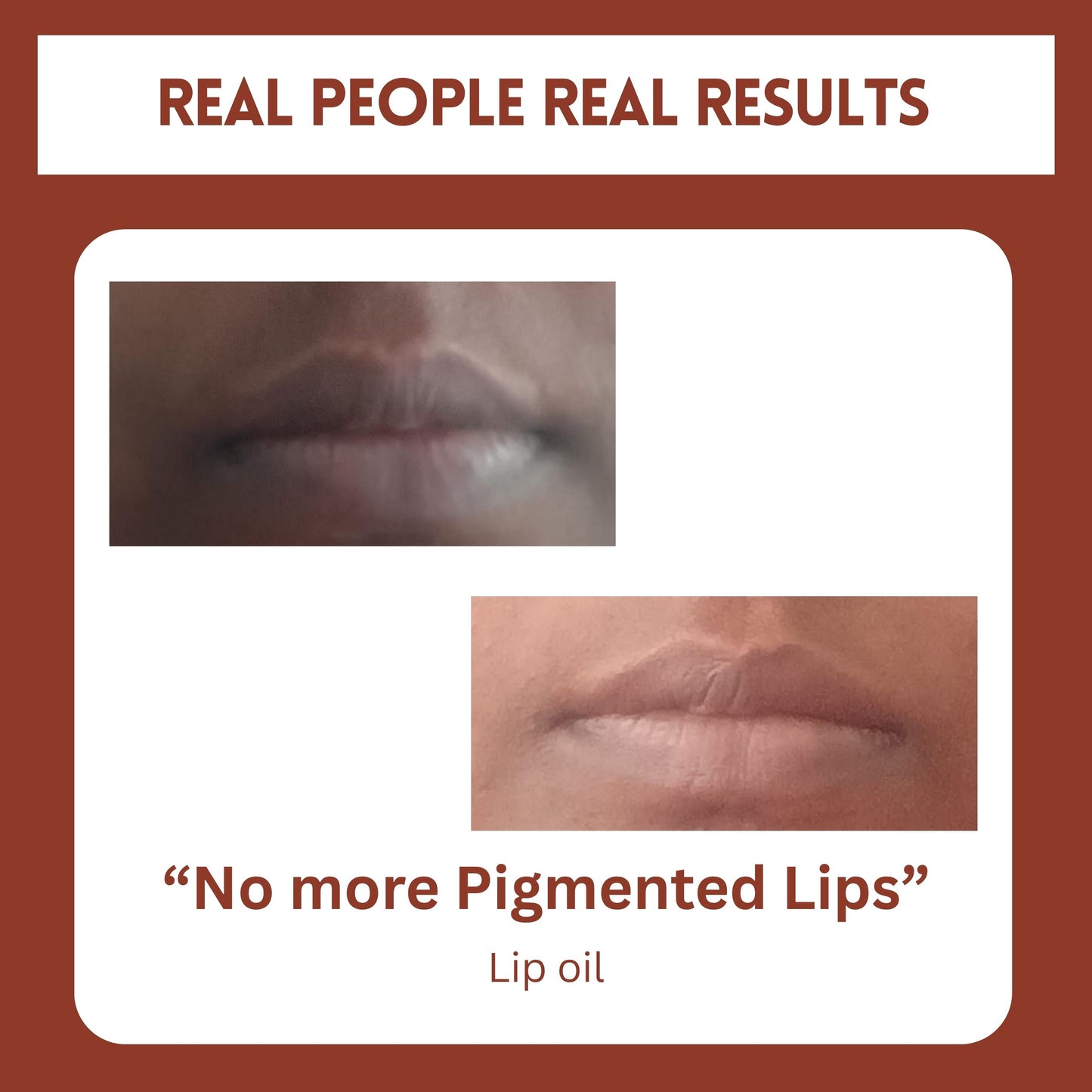 Lip Care Combo