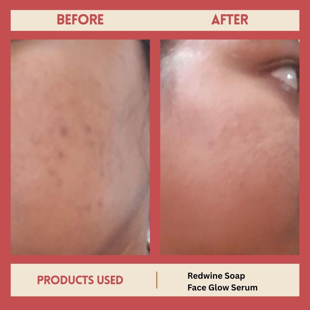 FACE GLOW SERUM AND REDWINE SOAP
